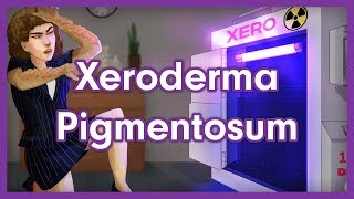 Xeroderma Pigmentosum Mnemonic for USMLE [upl. by Claud858]