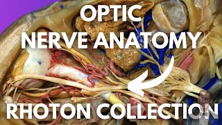 Optic Nerve Neuroanatomy Simplified Rhoton Collection [upl. by Notloc]