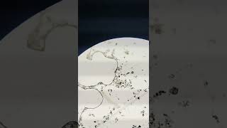 Zooplankton found in pond water biology microscopevideo [upl. by Valleau]