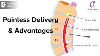 What is Painless Delivery Is epidural given during normal deliveryDrVanita Mande of C9 Hospitals [upl. by Yeta]