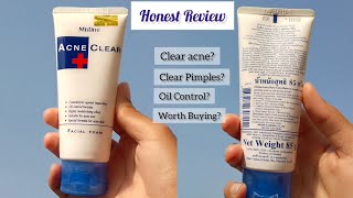 Honest Review of Mistine Acne Clear Face wash  Affordable Facewash for acne prone skin [upl. by Aytak]