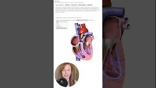 Next Gen NCLEX Case  Atrial Fibrillation EKG Pt 1 [upl. by Toiboid]