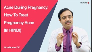 Acne During Pregnancy How To Treat Pregnancy Acne  ClearSkin Pune  In HINDI [upl. by Mikkanen]