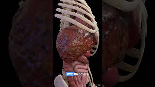 Understanding Liver Cirrhosis Key Facts anatomy meded 3dmodel [upl. by Turoff]