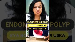 What is an Endometrial Polyp amp hows it treated  Endometrial Polyp in Hindi  Dr Nymphea Walecha [upl. by Llerral]