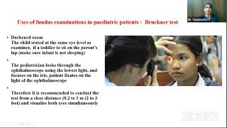 Fundus Examination [upl. by Garlaand]