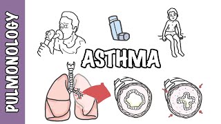 Understanding Asthma  pathophysiology and treatment [upl. by Hilary]