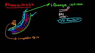 Pathophysiology of Atherosclerosis [upl. by Porett]