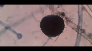 Fungus under Microscope Fungal structures Aspergillus [upl. by Anilyx]