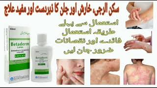 How To Use Betaderm Lotion For Allergy  BETADERM lotion uses in urdu  betaderm lotion full review [upl. by Sochor]