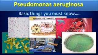 Pseudomonas aureginosaClear overview [upl. by Adnawt]