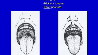 Preoperative Evaluation  Dr Hessel [upl. by Dinesh]