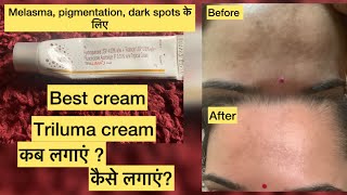 Triluma cream for pigmentation  bad or good skincare pigmentation melasma skincareroutine [upl. by Madian]