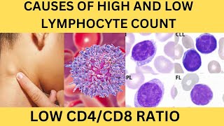 CAUSES OF HIGH LYMPHOCYTE COUNTLOW LYMPHOCYTE CD4CD8 LESS THAN 1REACTIVE LYMPHOCYTESCLLALL [upl. by Annohsat]