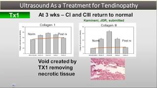 Webinar Series Deep Tissue Applications with the new TX2 MicroTip  Tony Joseph MD [upl. by Calvinna]