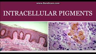 Intracellular pigments [upl. by Nylirahs]