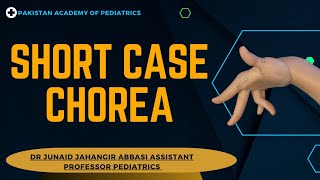 Short Case Chorea  Teaching on Patient [upl. by Leen]