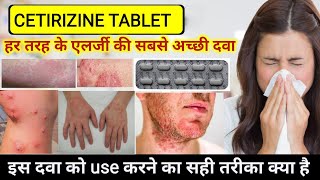 cetirizine hydrochloride tablets ip 10mg in hindi  Cetirizine tablets uses  Allergy Treatment [upl. by Hirza]