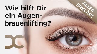 Augenbrauenlifting  Alles was du wissen solltest  Dorow Clinic [upl. by Asoramla]