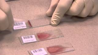 IDEXX  How to make a Blood Film in 3 steps [upl. by Yenwat731]