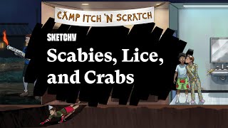 Scabies Lice amp Crabs A Study Guide Part 1  Sketchy Medical  USMLE Step 1 [upl. by Akinek]