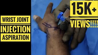 Wrist InjectionAspiration Technique [upl. by Donni]