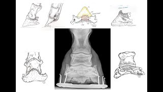 Tutorial anatomía radiográfica de P3 vista dorso palmar [upl. by Lori]