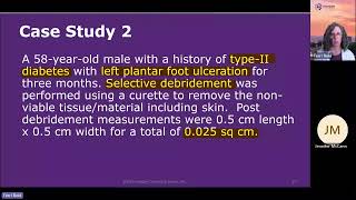 HCGTV Webinar Snippet  Coding Diabetes with an Ulceration Case Study [upl. by Wivina]