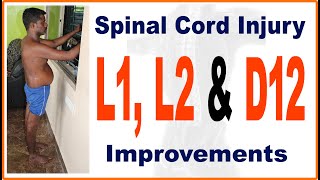 Spinal Cord Injury L1 L2 amp T12  5 Days Improvements  spine spinalcordinjury spineinjury [upl. by Macdermot]