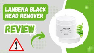 LANBENA Blackhead Remover Review Does It Really Work [upl. by Jet]