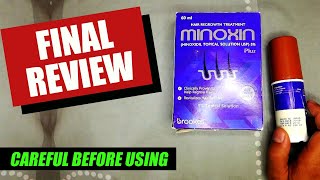 FINAL REVIEW  Minoxin Plus 5 Hair Spray Minoxidil Results  UrduHindi [upl. by Ahsym]