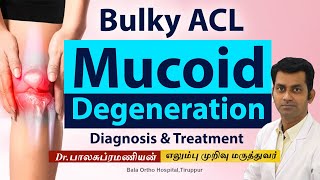 ACL Mucoid Degeneration in Knee  Diagnosis amp Treatment  Dr Balasubramanian MS Ortho [upl. by Ful333]