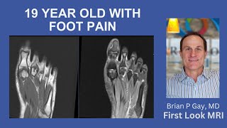 19 year old with foot pain [upl. by Derraj]