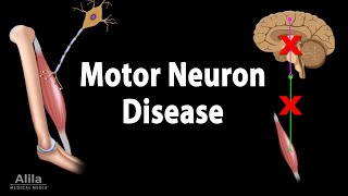 Motor Neuron Disease Animation [upl. by Sredna]