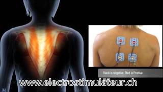 Placement et Position Electrode Compex Haut du Dos sur ElectrostimulateurCH [upl. by Renate]