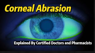 Corneal Reflex Assessment  CN V  OSCE Clip  UKMLA  CPSA  PLAB 2 [upl. by Reinal972]