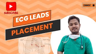 ECG Leads placement ECG electrode placement  EASY EXPLANATION ECG TYPES OF ECG LEADSecg [upl. by Holly-Anne]