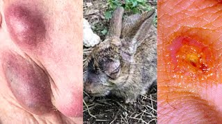 WHAT IS TULAREMIA SYMPTOMS CAUSES TREATMENT [upl. by Mcnamee]