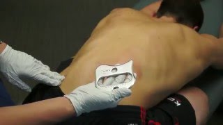 IASTM Anchoring Technique  Instrument Assisted Soft Tissue Mobilization [upl. by Aerdna]