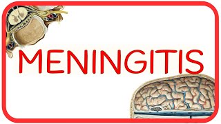 MENINGITIS  fisiopatología signo de Brudzinski y Kernig diagnóstico diferencial LCR y tratamiento [upl. by Sanyu31]