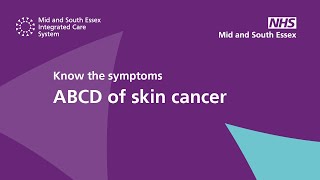 Know the symptoms ABCD of skin cancer [upl. by Simmons]