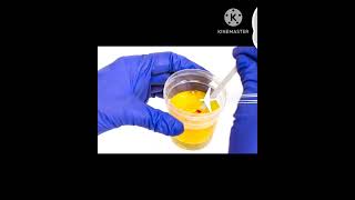 Microalbumin dipstick test urinalysis microalbuminuria science medical microscopic [upl. by Ahsael]