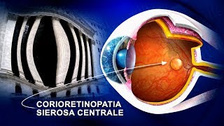 Corioretinopatia sierosa centrale CSCR terapia wwwoculisticaTVit [upl. by Nnaael]