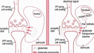 Amyotrophic Lateral Sclerosis [upl. by Nelehyram21]