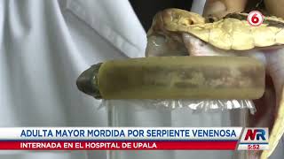 Adulta mayor en estado crítico por mordedura de una serpiente terciopelo [upl. by Andrej]