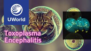 Toxoplasma gondii amp Toxoplasma encephalitis  UWorld USMLE Step 1 Question Nervous SystemNeurology [upl. by Fairfield]