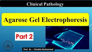 The Principle of Agarose Gel Electrophoresis a full explanatory video [upl. by Janelle277]