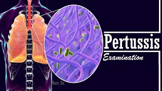 Pertussis Whooping Cough  Nursing examination  Assessment and Management [upl. by Nace]