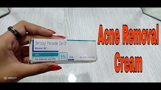 Benzoyl Peroxide 5 Gel Review in Hindi  Acne and Pimples Treatment [upl. by Rivalee]