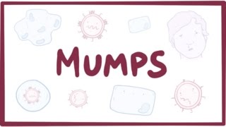 Mumps  symptoms diagnosis treatment pathology [upl. by Eedahs]